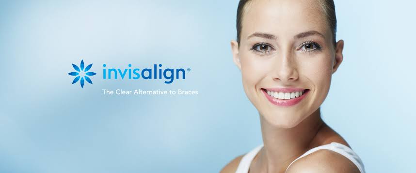 How Invisalign actually works (and how long it really takes)