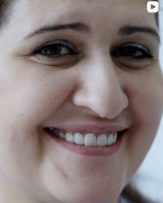 A new smile, on the day it was finished