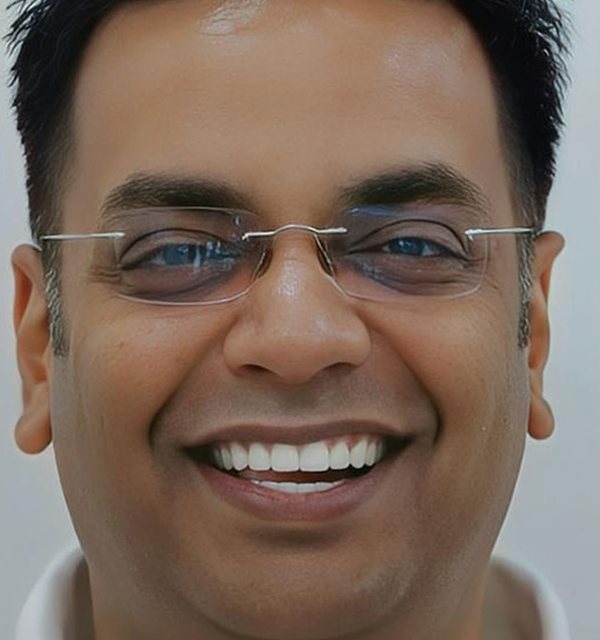 After E-max porcelain veneers, Hollywood smile